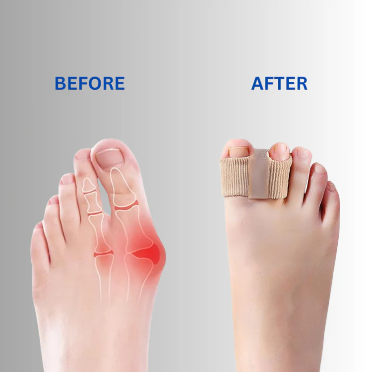 1 Par + 2 Par GRATIS IDAG | AlignToe™ - Image 2