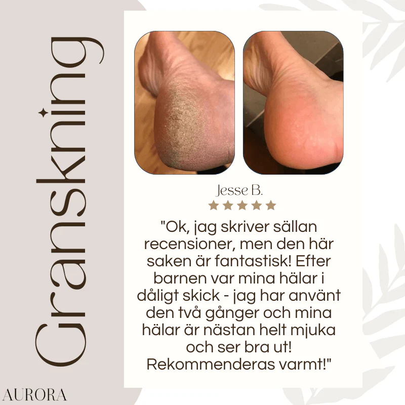 TILLFÄLLIGT 50% RABATT | CallusMaster™ - Electric Callus Master - Image 8