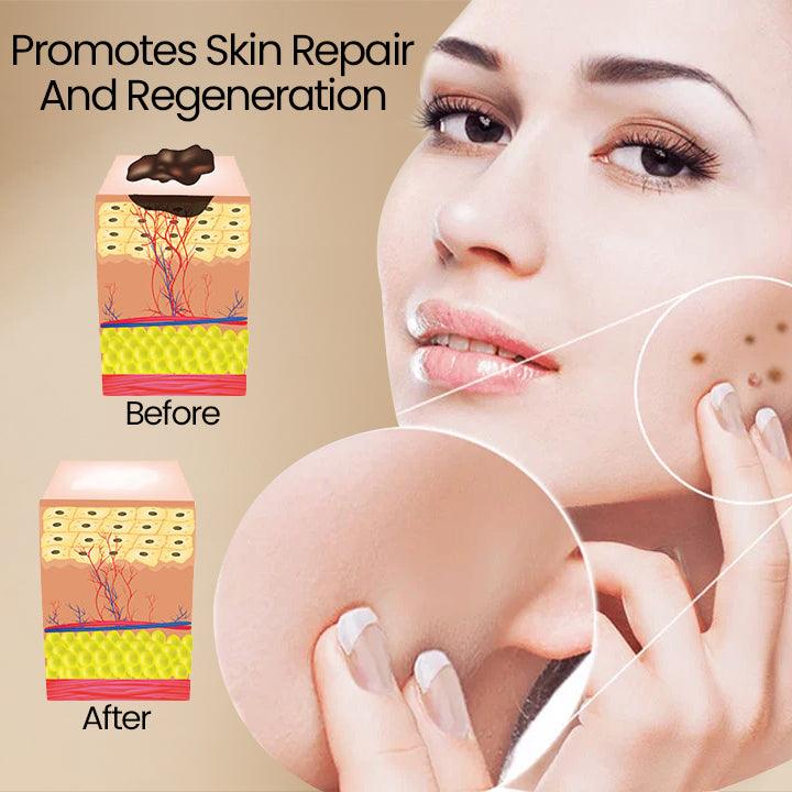 ClearSkinâą | Bienegift Vortborttagningsspray - Image 2