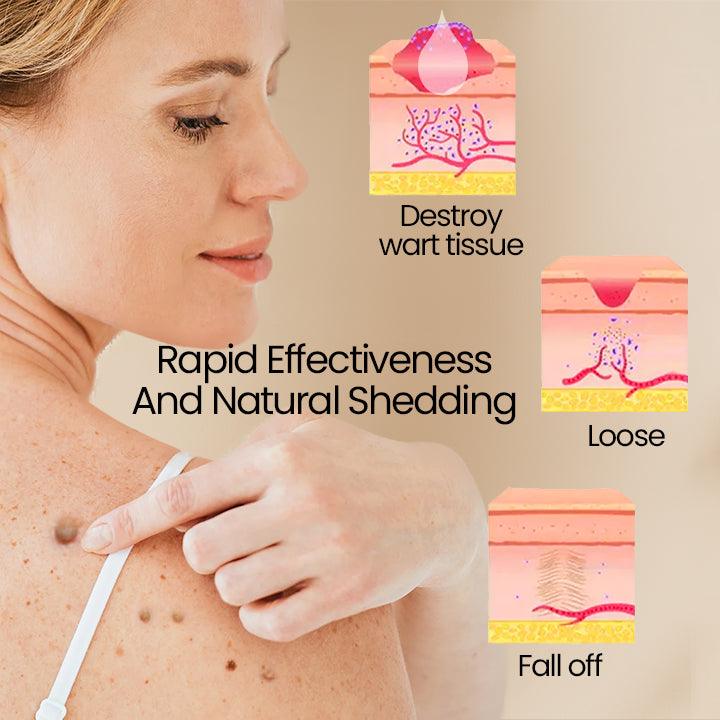 ClearSkinâą | Bienegift Vortborttagningsspray - Image 3