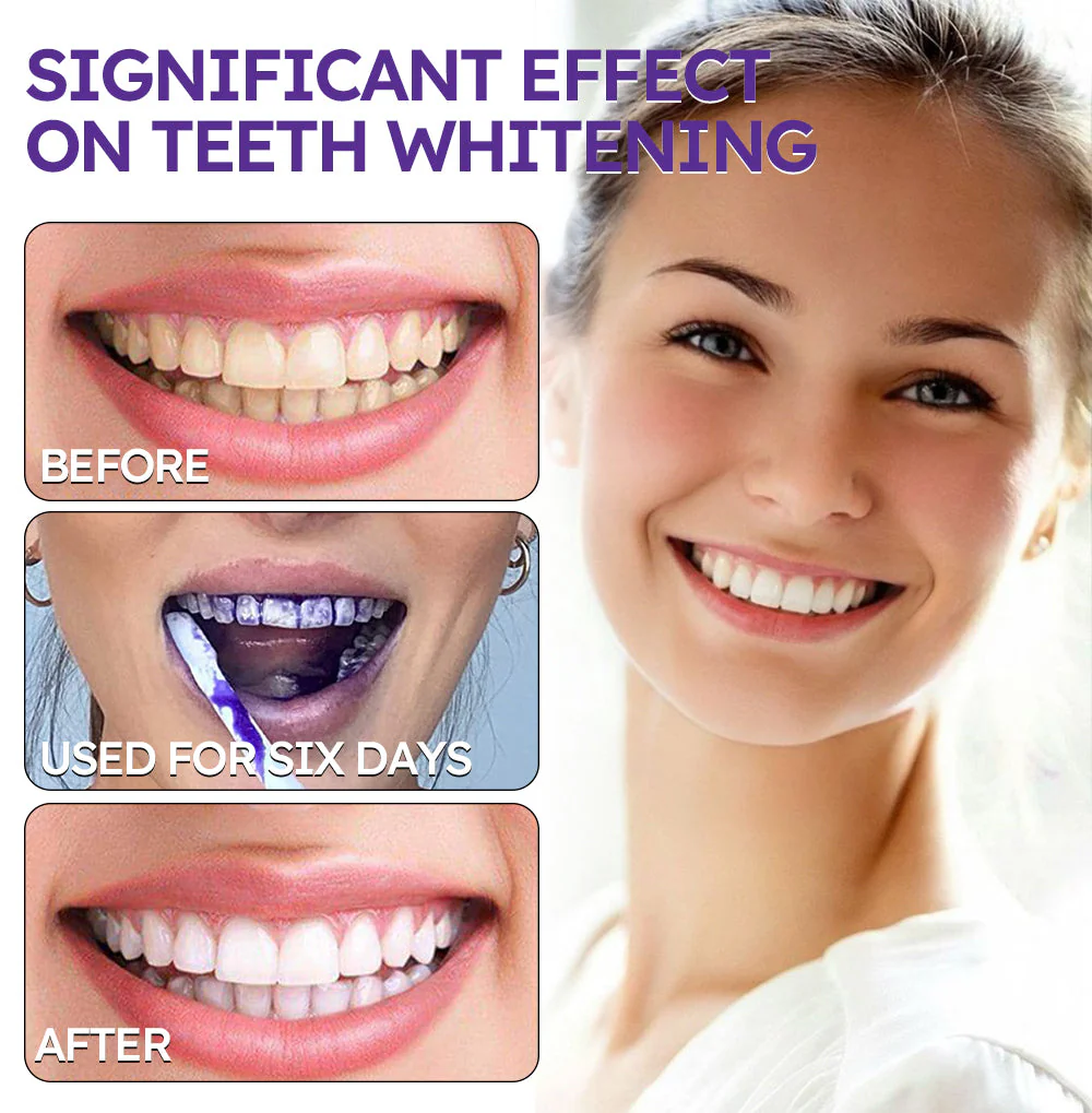 1 + 1 GRATIS IDAG | DentiGlow™ - Image 4
