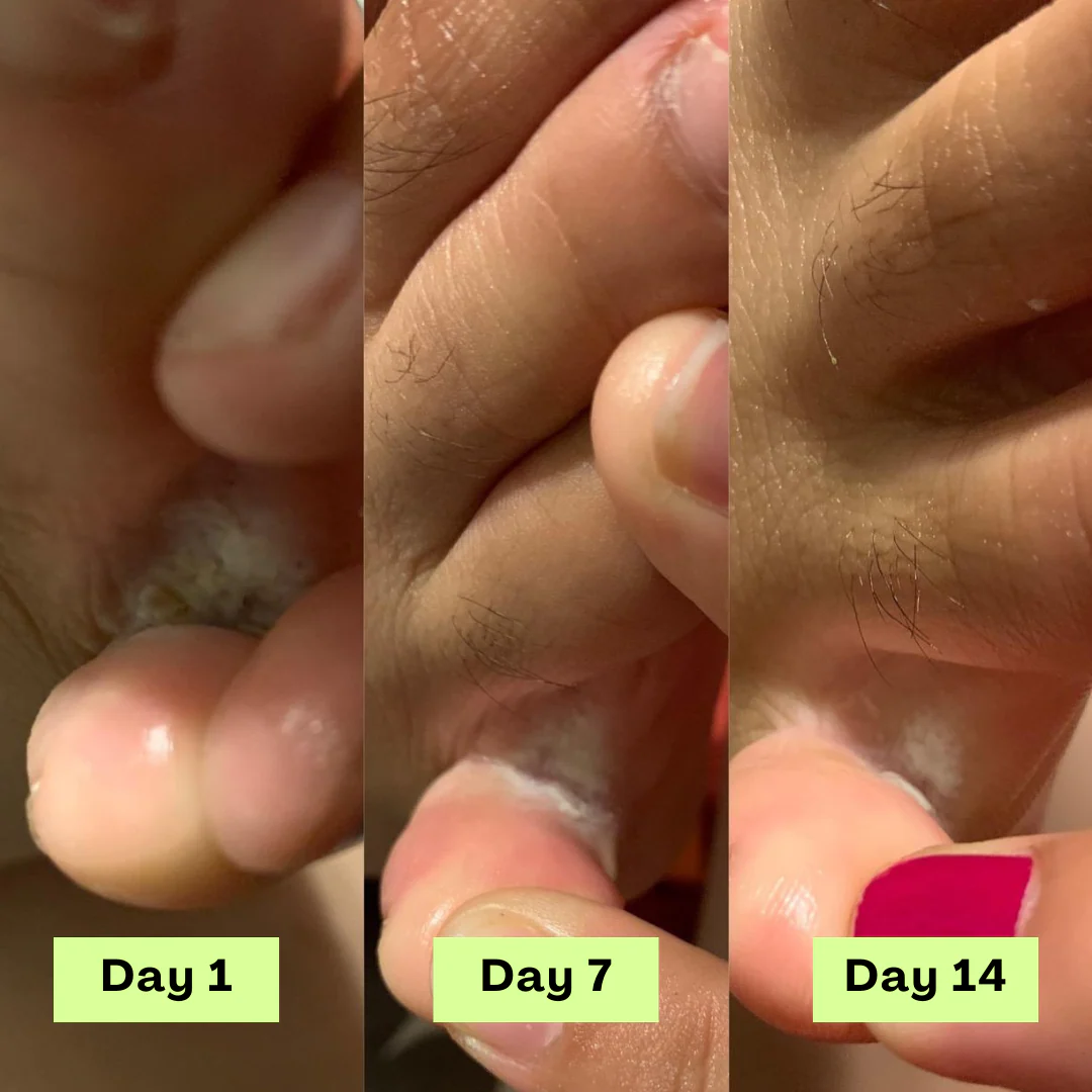 1 + 2 GRATIS IDAG | DermaCure™ - Image 4
