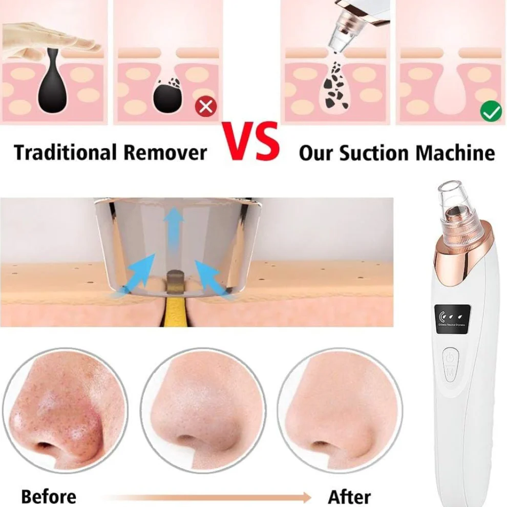 TILLFĂLLIGT 50% OFF | DermaVeoâą - Image 2