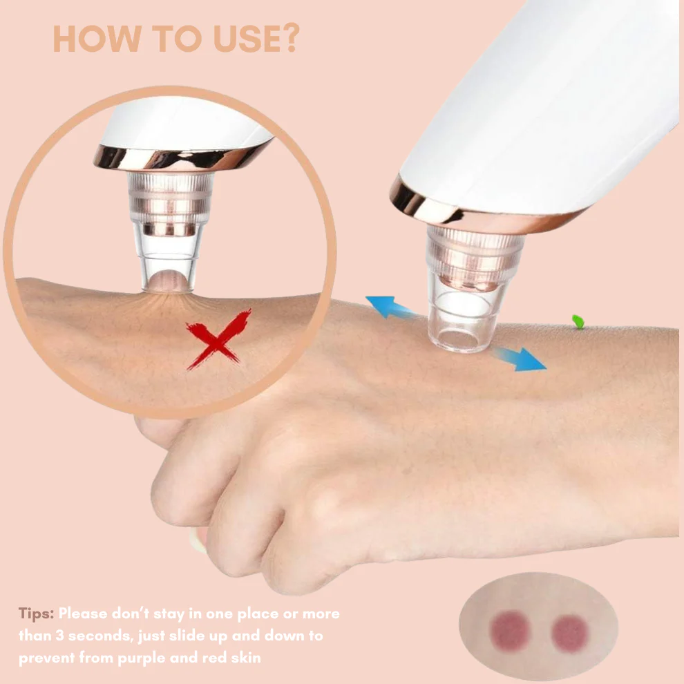 TILLFĂLLIGT 50% OFF | DermaVeoâą - Image 4
