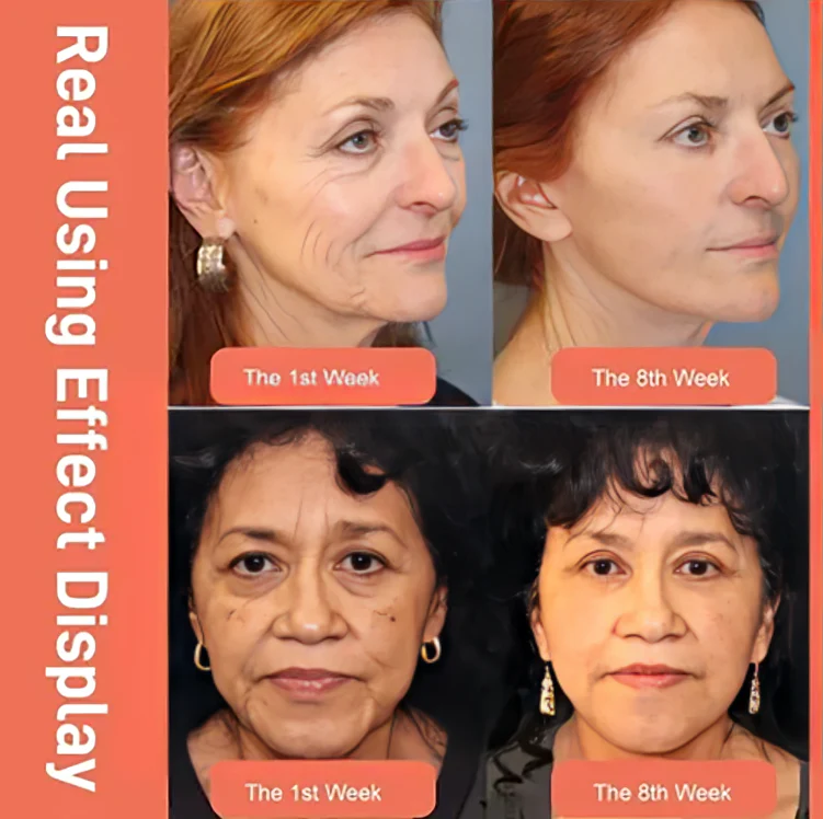 1 + 1 GRATIS IDAG | FirmGlow™ | Retinol Drakblod Anti-rynkkräm - Image 2