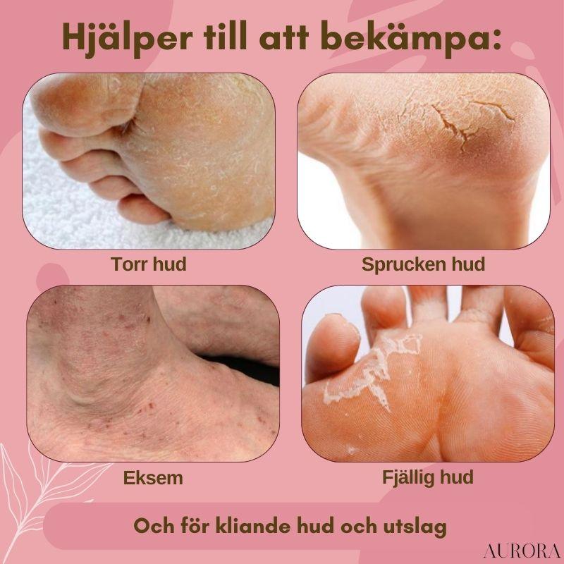 Miniatyrbild 2