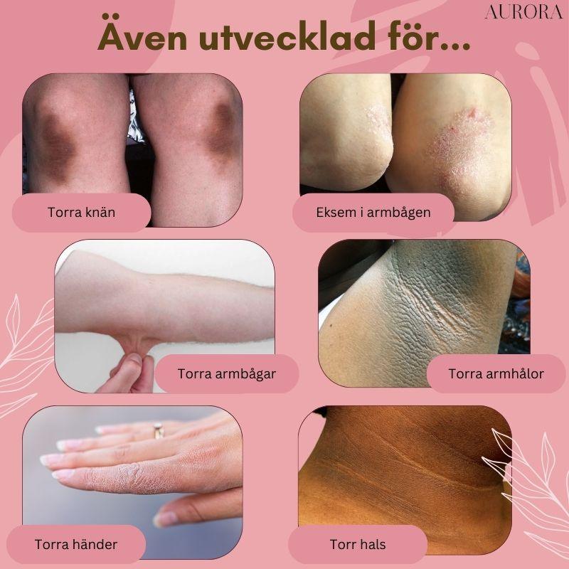 1 + 1 GRATIS IDAG | FootVitalize™ - Foot Finish Foot Repair Cream - Image 4
