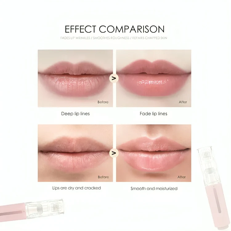 TILLFÄLLIGT 50% RABATT | LipLift™ | Mikronålsrulle för läppar - Image 2