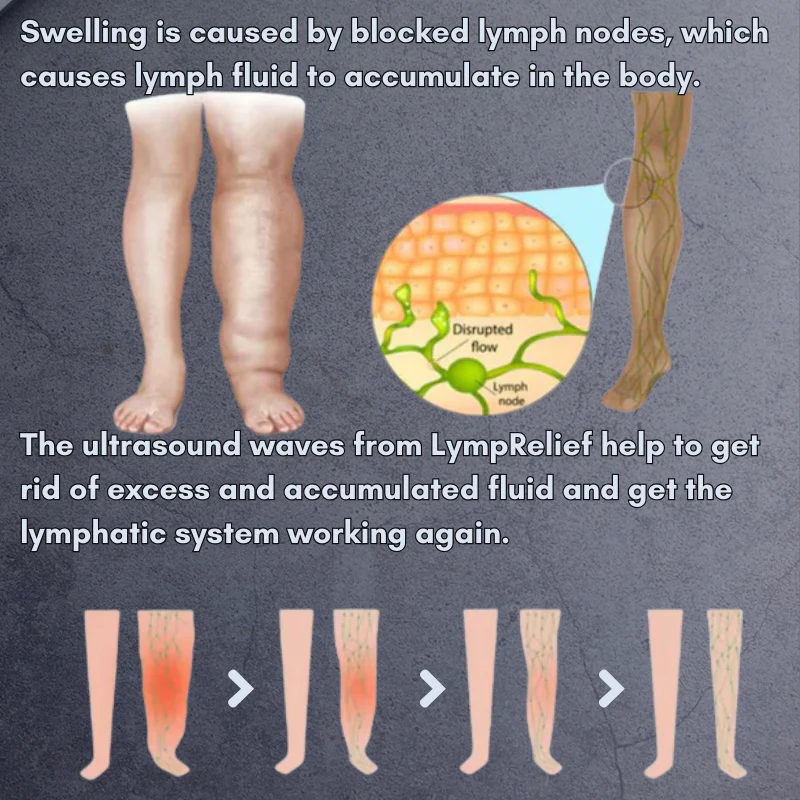 TILLFÄLLIGT 50% OFF | LymphRelief™ - Image 4