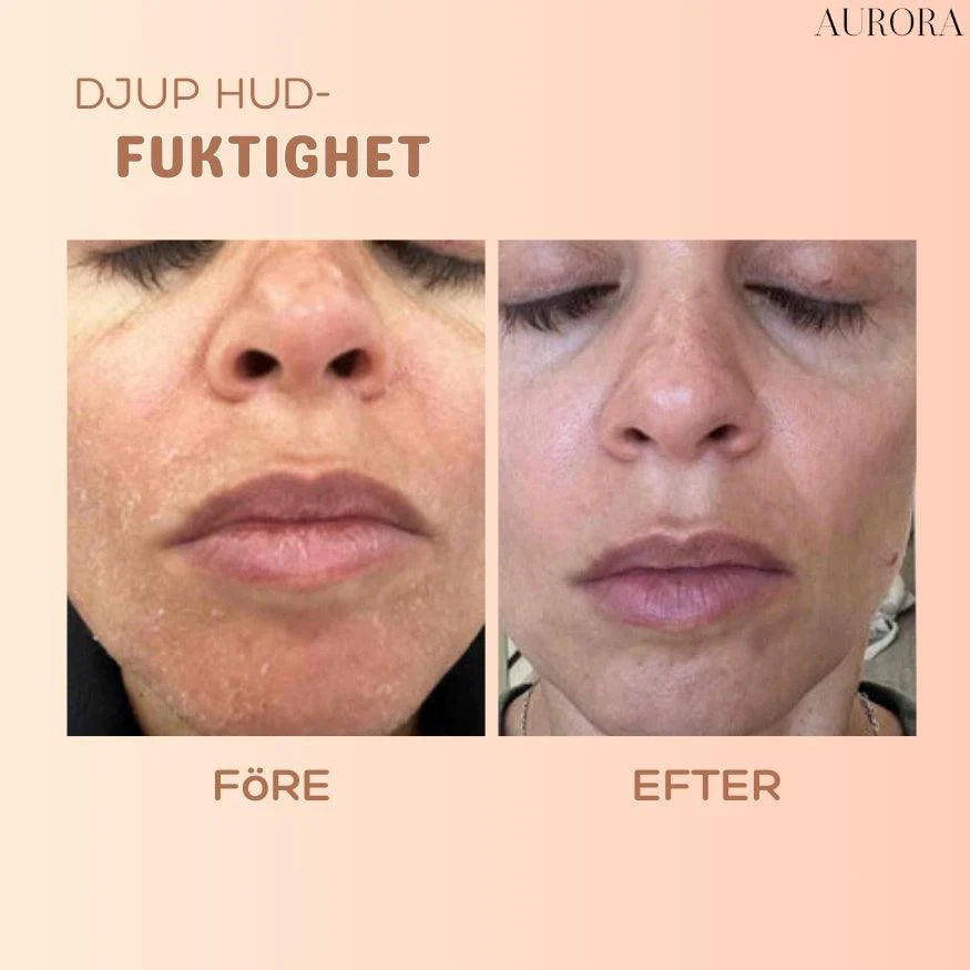 1 + 1 GRATIS IDAG | MultiBalm™ - hudförnyande stift mot rynkor - Image 4