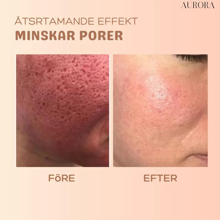 1 + 1 GRATIS IDAG | MultiBalm™ - hudförnyande stift mot rynkor - Image 5