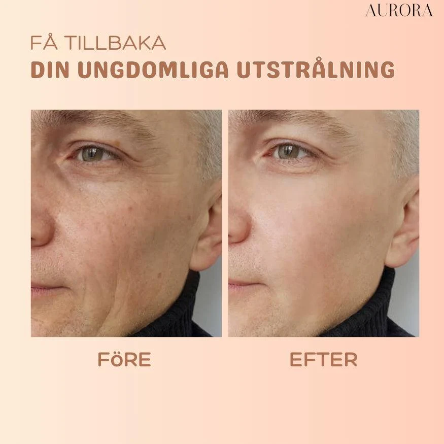 1 + 1 GRATIS IDAG | MultiBalm™ - hudförnyande stift mot rynkor - Image 6
