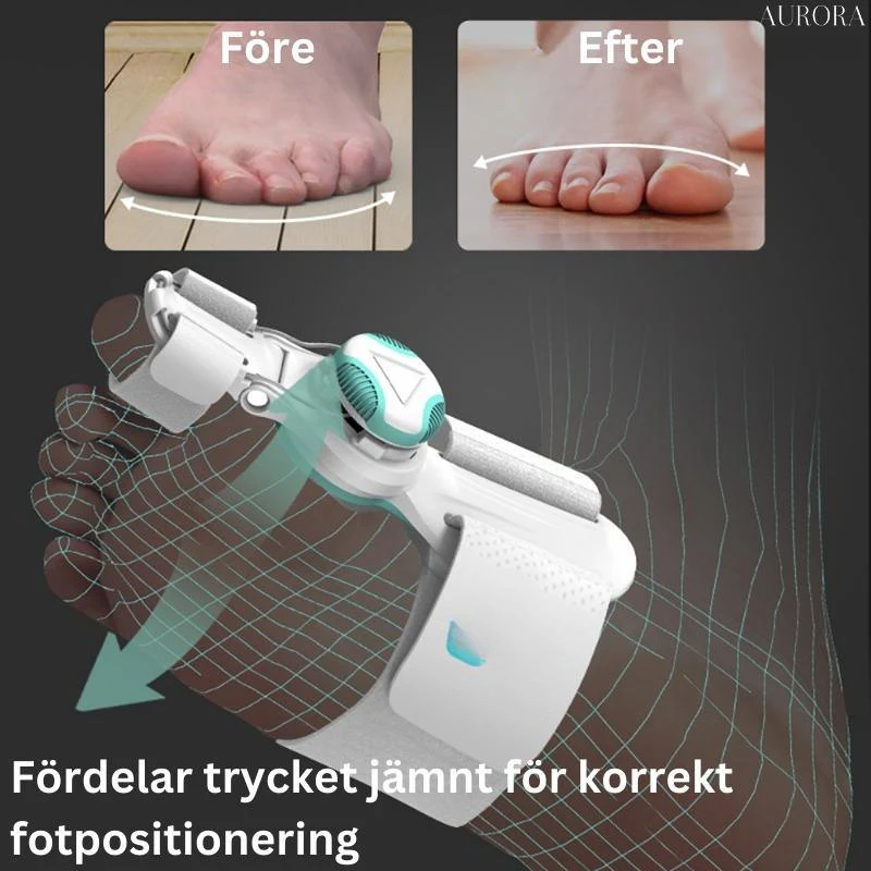 OrthoAlign™ – Korrigerare för snea tår | BEGRÄNSAD 50%-75% RABATT - Image 8