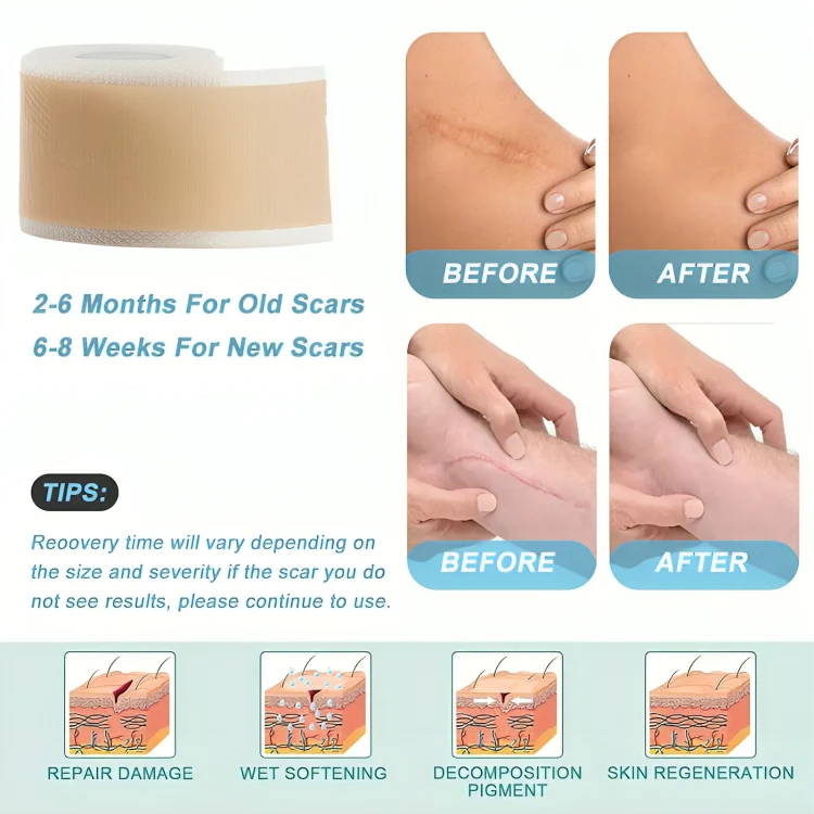 1 + 1 GRATIS IDAG | SkinMend™ | Sudda ut ärr & rynkor! - Image 4