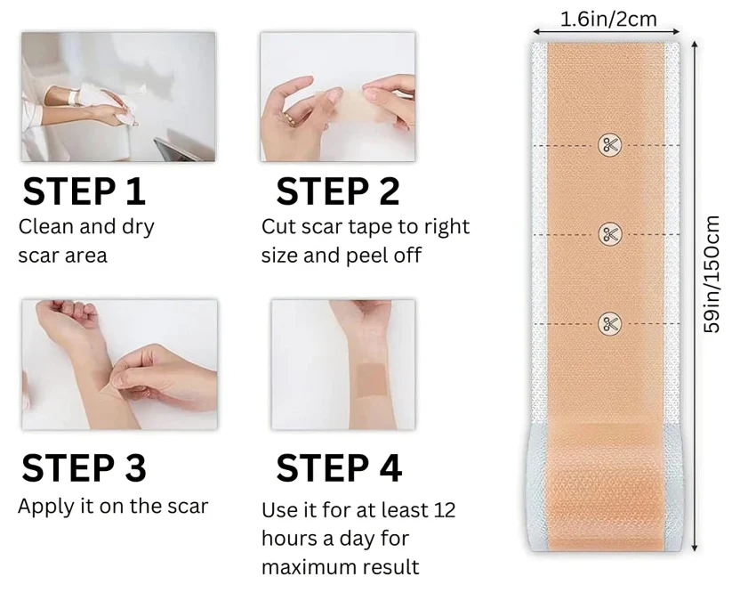 1 + 1 GRATIS IDAG | SkinMend™ | Sudda ut ärr & rynkor! - Image 8