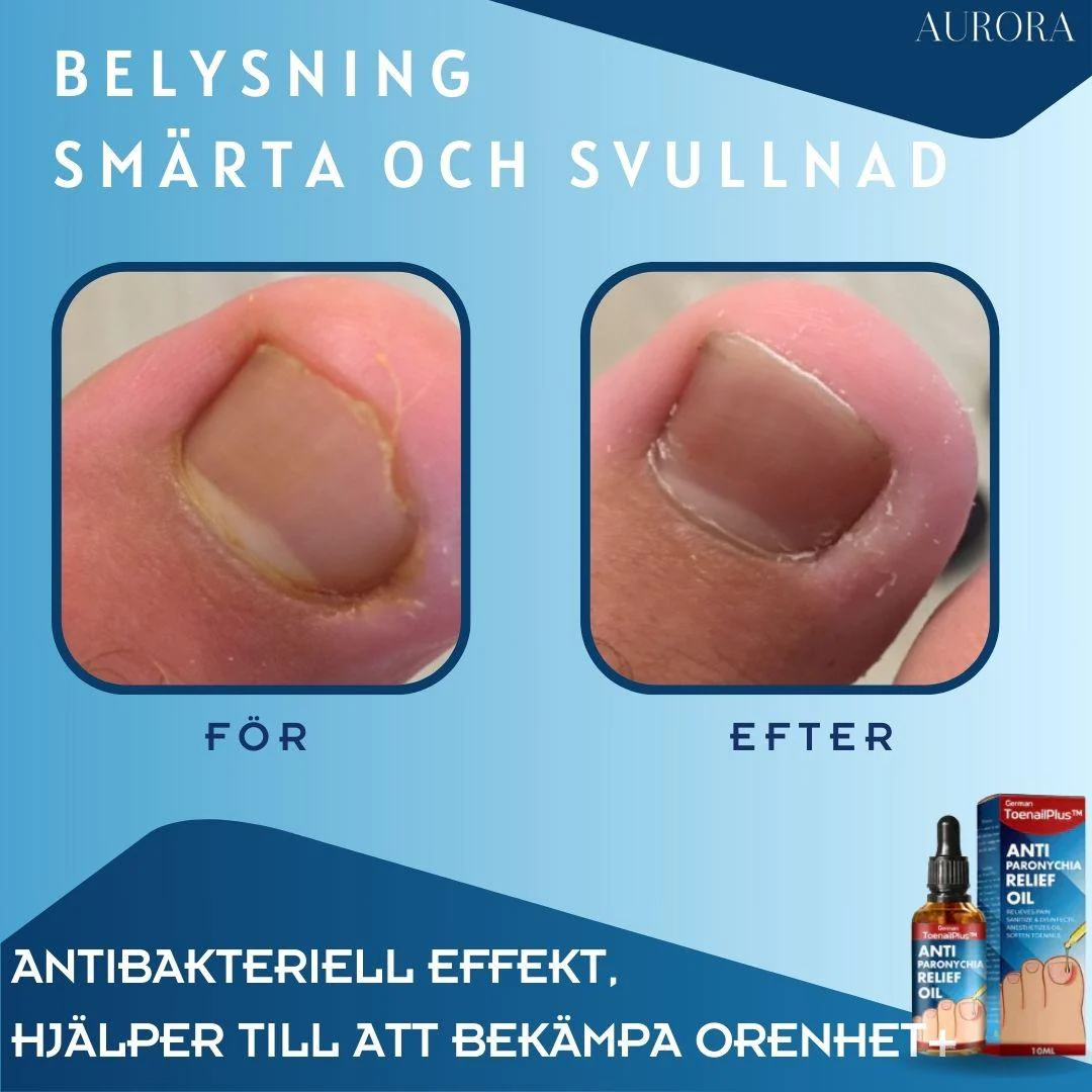 1 + 1 GRATIS IDAG | ToePerfect™ - Läker tånaglar och handnaglar - Image 3