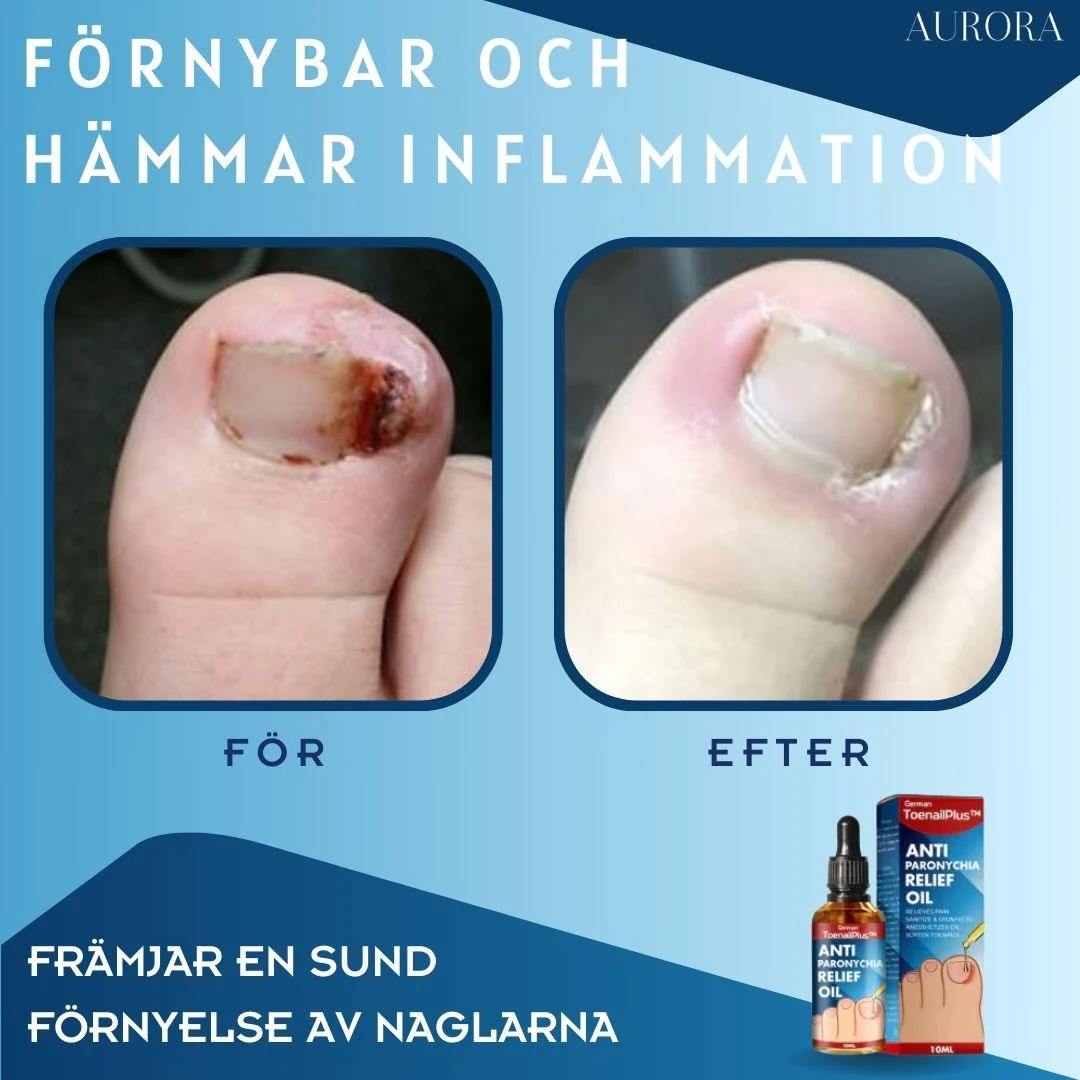 1 + 1 GRATIS IDAG | ToePerfect™ - Läker tånaglar och handnaglar - Image 5