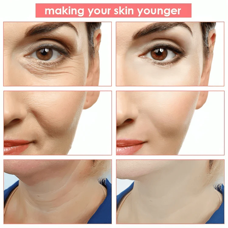 ToneLift™ | Huduppstramande ansiktsmassage - Image 2