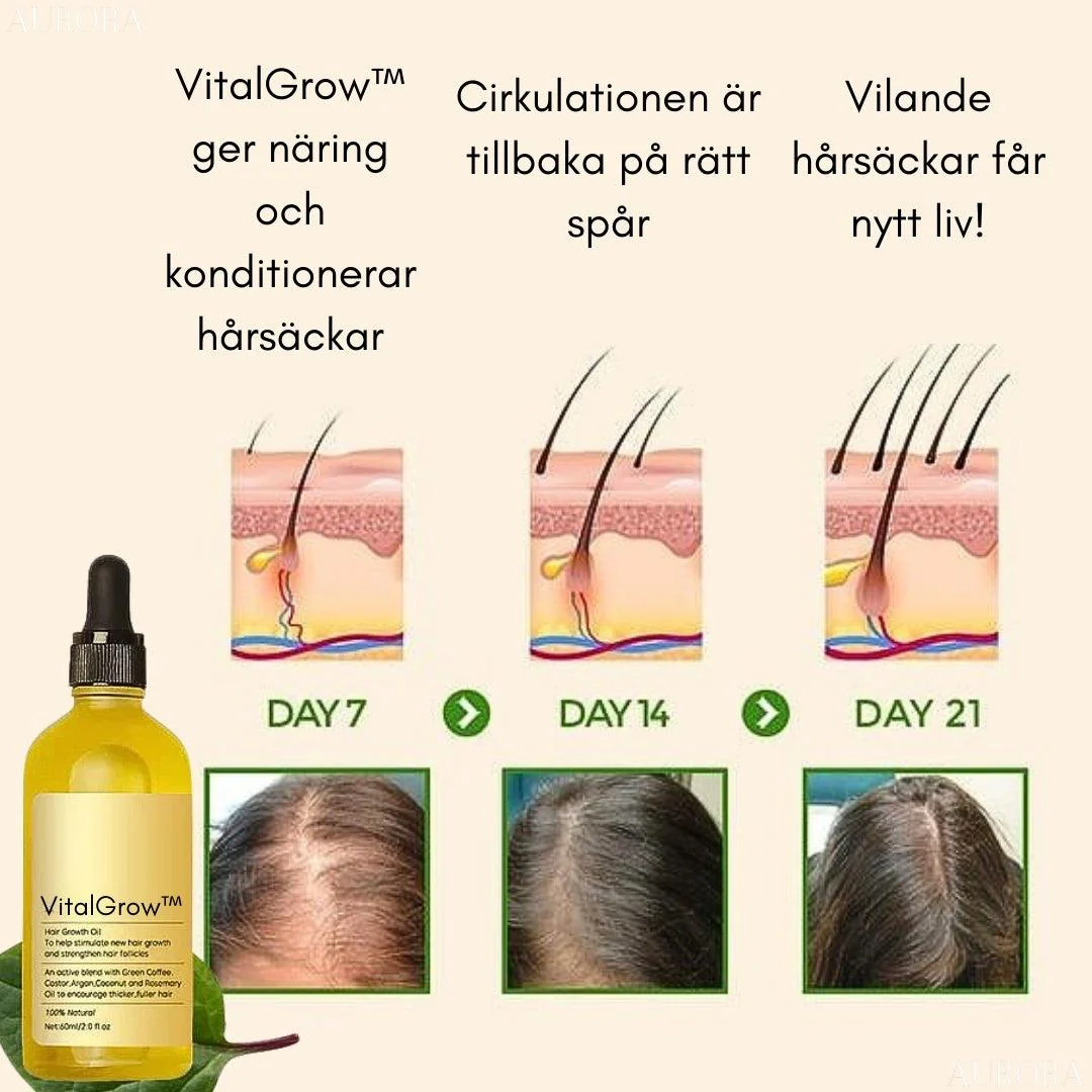 TILLFÄLLIGT 50% RABATT | VitalGrow™ |  Din Naturliga Oljebehandling För Hårväxt - Image 2