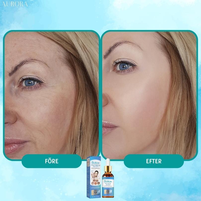 1 + 1 GRATIS IDAG | YouthGlow™ | Botox Antialterung Serum - Image 3