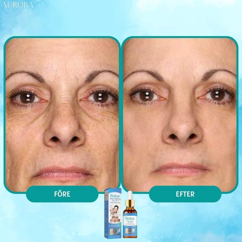 1 + 1 GRATIS IDAG | YouthGlow™ | Botox Antialterung Serum - Image 4