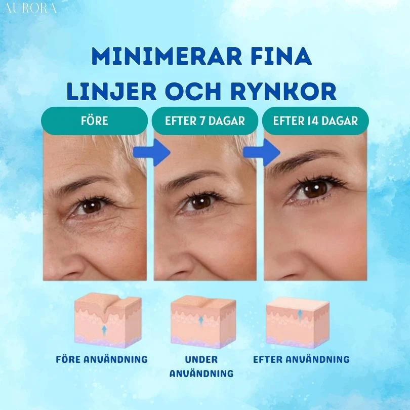 1 + 1 GRATIS IDAG | YouthGlow™ | Botox Antialterung Serum - Image 6